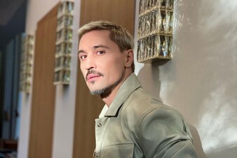 «Проблема обострилась»: Дима Билан готовится к операции